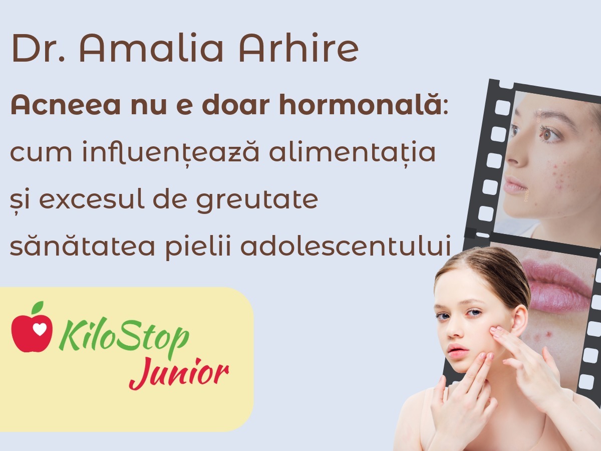 Acneea este una dintre cele mai frecvente probleme ale adolescenței și afectează atât pielea, cât și încrederea în sine a copiilor.